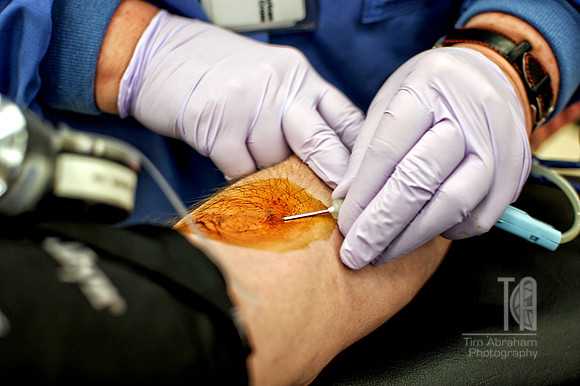 Day 92. It's blood donation day! One more unit given in August will make 17 gallons. Whew.